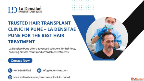 Trusted Hair Transplant Clinic in Pune - La Densitae Pune for the Best Hair Treatment