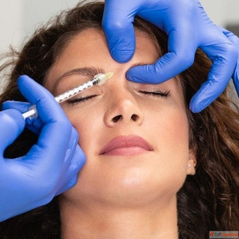 Dermal Fillers Injections