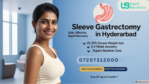 Sleeve Gastrectomy Operation in Hyderabad Top Weight Loss Clinic