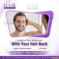 Non Surgical Hair Replacement - A Game-Changer for Hair Loss