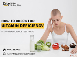 How to Check for Vitamin Deficiency - Vitamin Deficiency Tes...