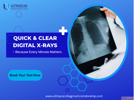 Walk-In Digital X-Ray Services Available in Indore