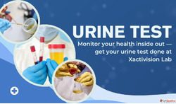 Recurring UTIs When Did You Last Get a Urine Culture Test