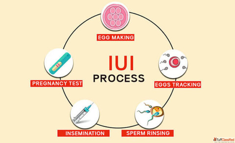 IUI Treatment Cost in Delhi - Dr Rhythm Gupta
