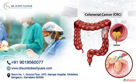 Whitefield Colorectal Cancer Care - Sumitobesitycare
