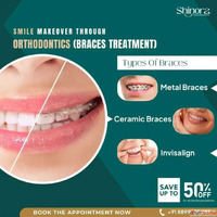 Shinora Clinic - Orthodontic Treatment in Ahmedabad