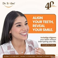 Invisalign Treatment in Hyderabad - Dr Smiles
