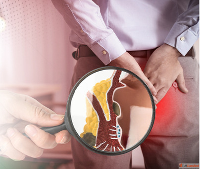 Trusted Piles Surgery Hospital in Greater Noida NCR