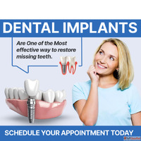 Get Your Smile Back with Affordable Dental Implants
