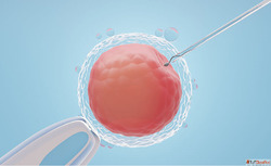 Egg Freezing in Endometriosis What You Should Know