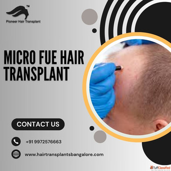 Best FUE Hair Transplant in Bangalore FUE Hair Transplant Cost