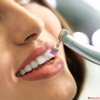 Teeth Polishing and Scaling in Dubai