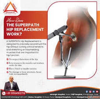 SuperPath hip surgery in Pune - Dr. Aashish Arbat