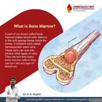 bone marrow transplant in Hyderabad