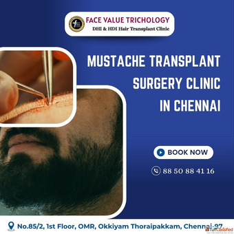 The Best Hair Transplant Suregeon Clinic in Chennai