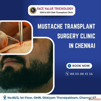 The Best Hair Transplant Suregeon Clinic in Chennai