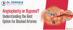 Angioplasty vs Bypass Best Treatment for Blocked Arteries