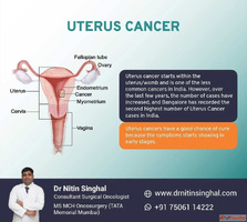 Robotic Uterus Cancer Surgery in Ahmedabad India Less Invasi...