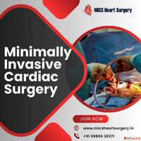 Minimally Invasive Cardiac Surgery in Bangalore Expert Surge...