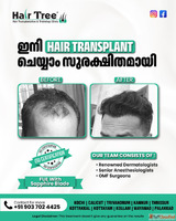 Safest Hair Transplantation Clinic in Kerala Hair Tree
