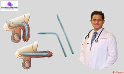 Expert Doctor for Penile Implant Surgery in Bangalore