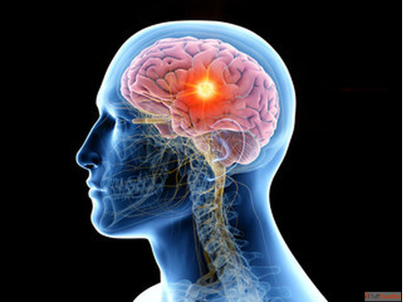 Brain Surgery in India