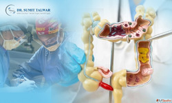 Trusted Colorectal Surgeon in Bangalore-Sumitobesitycare