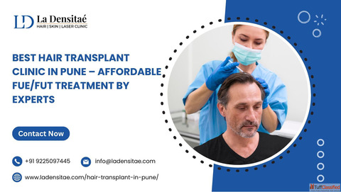 Best Hair Transplant Clinic in Pune - Affordable FUEFUT Treatment by Experts