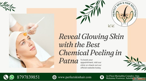Best Chemical Peel Treatment in Patna