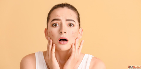 Clear Your Skin with Trusted Acne Treatment in Delhi by Dr. Jaya