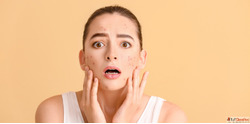 Clear Your Skin with Trusted Acne Treatment in Delhi by Dr. ...