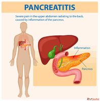 The Top 7 Ozempic Pancreatitis Symptoms You Need to Be Aware...
