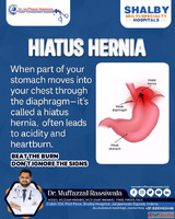 Hiatus Hernia Treatment in Indore Dr. Muffazzal Rassiwala