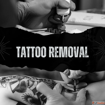 Tattoo Removal Treatment in Mumbai Safe Effective and Expert-Guided