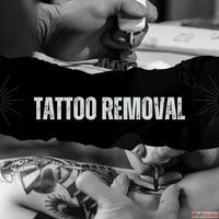 Tattoo Removal Treatment in Mumbai Safe Effective and Expert...