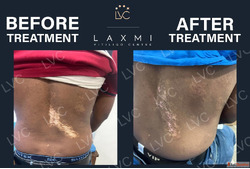 Best Doctor Best Homeopathic Vitiligo Treatment and Packs.