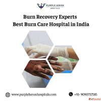 Burn Recovery Experts - Best Burn Care Hospital in India