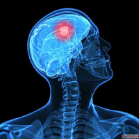Best Neurosurgery Hospital in Chennai Expert Neurosurgeon