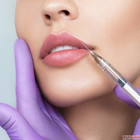 Lip Augmentation
