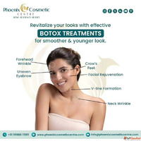 Affordable Botox Treatment in Ahmedabad at Phoenix Cosmetic ...