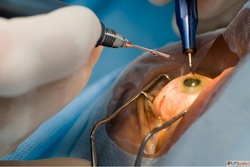 Discover Top Cataract Surgery at Claritas Eye Retina Institu...