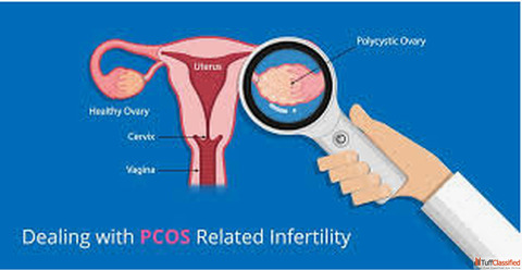 Trusted PCOS Doctor Near me for Personalized Women's Health Care