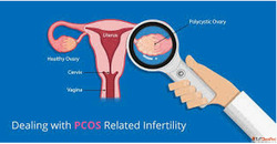 Trusted PCOS Doctor Near me for Personalized Women's He...