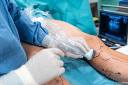 Consult Experts for Peripheral Vascular Disease in Noida