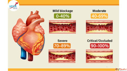 Heart Attack vs Heart Failure Causes Symptoms EECP Treatment