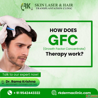 Want Stronger Healthier Hair Discover the Magic of GFC Therapy at RK Clinic