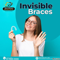 Best Invisalign Providers in Secunderabad and Hyderabad