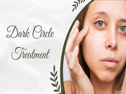  Best Dark Circle Removal in Mumbai at Gloss Clinic