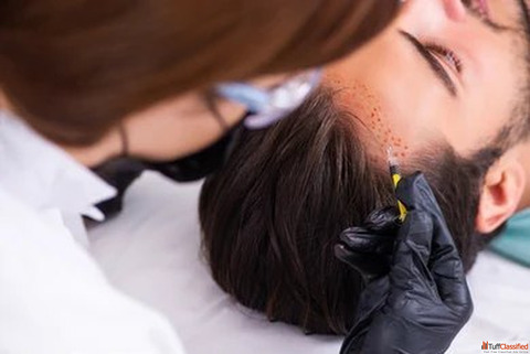 Searching for Hair Transplant Experts in Gorakhpur