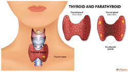 Safe and Effective Homeopathy Treatment for Thyroid Issues